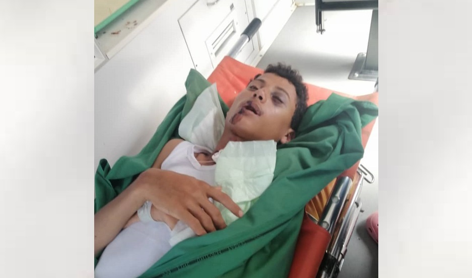 لاحقت قذائف الإجرام الحوثي أحمد إلى بقالة بدأ يعيل أسرته من عمله فيها