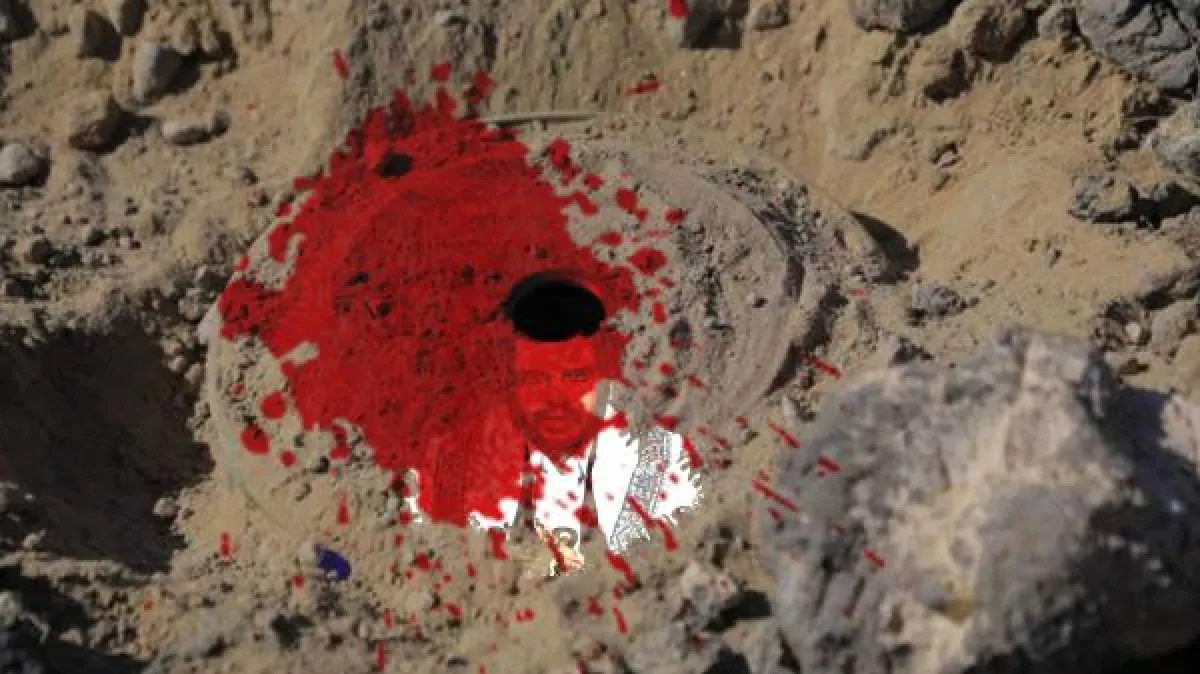 إصابة أربعة أطفال أشقاء بانفجار لغم حوثي في الدريهمي