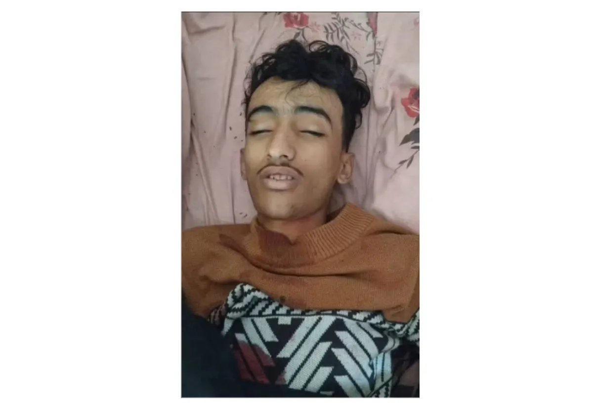 مركز تعز الحقوقي يدين مقتل الطفل عمار الشريحي برصاص مليشيا الحوثي بمديرية صبر الموادم